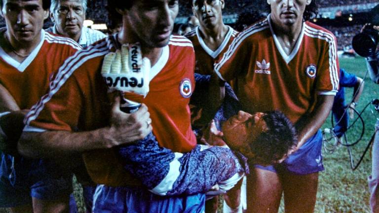 Roberto Rojas, dan Sepakbola yang Berdarah-darah
